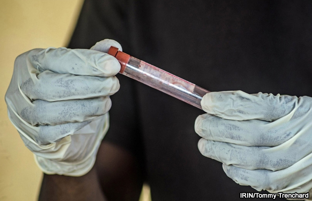 20140923-ebola-test-un